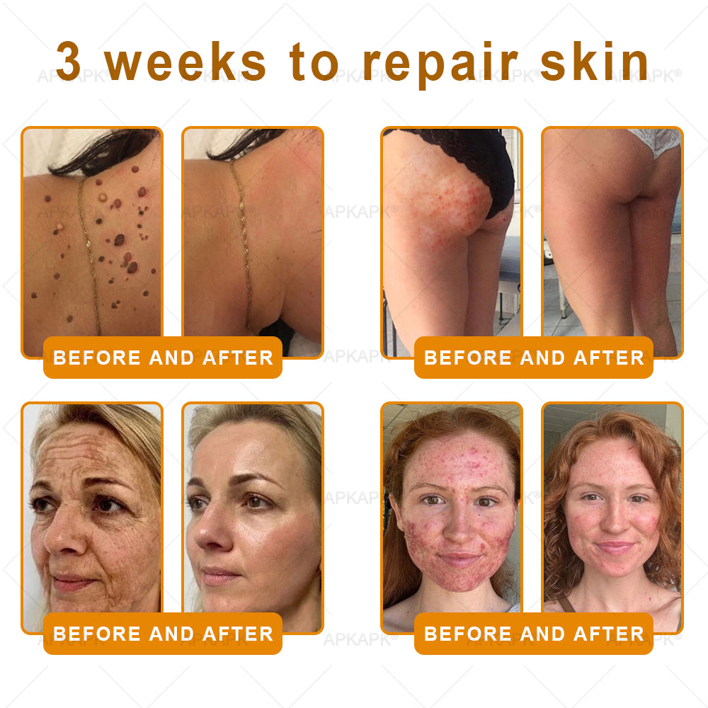 APKAPK®--Only 10 jars! Grab an exclusive 30% discount now! Keep your skin youthful and glowing in just 1 to 3 weeks. Don’t miss your chance—this offer won’t come around again until next year. Act fast! 180-day money back guarantee!