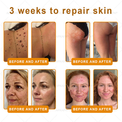 APKAPK®--Only 10 jars! Grab an exclusive 30% discount now! Keep your skin youthful and glowing in just 1 to 3 weeks. Don’t miss your chance—this offer won’t come around again until next year. Act fast! 180-day money back guarantee!