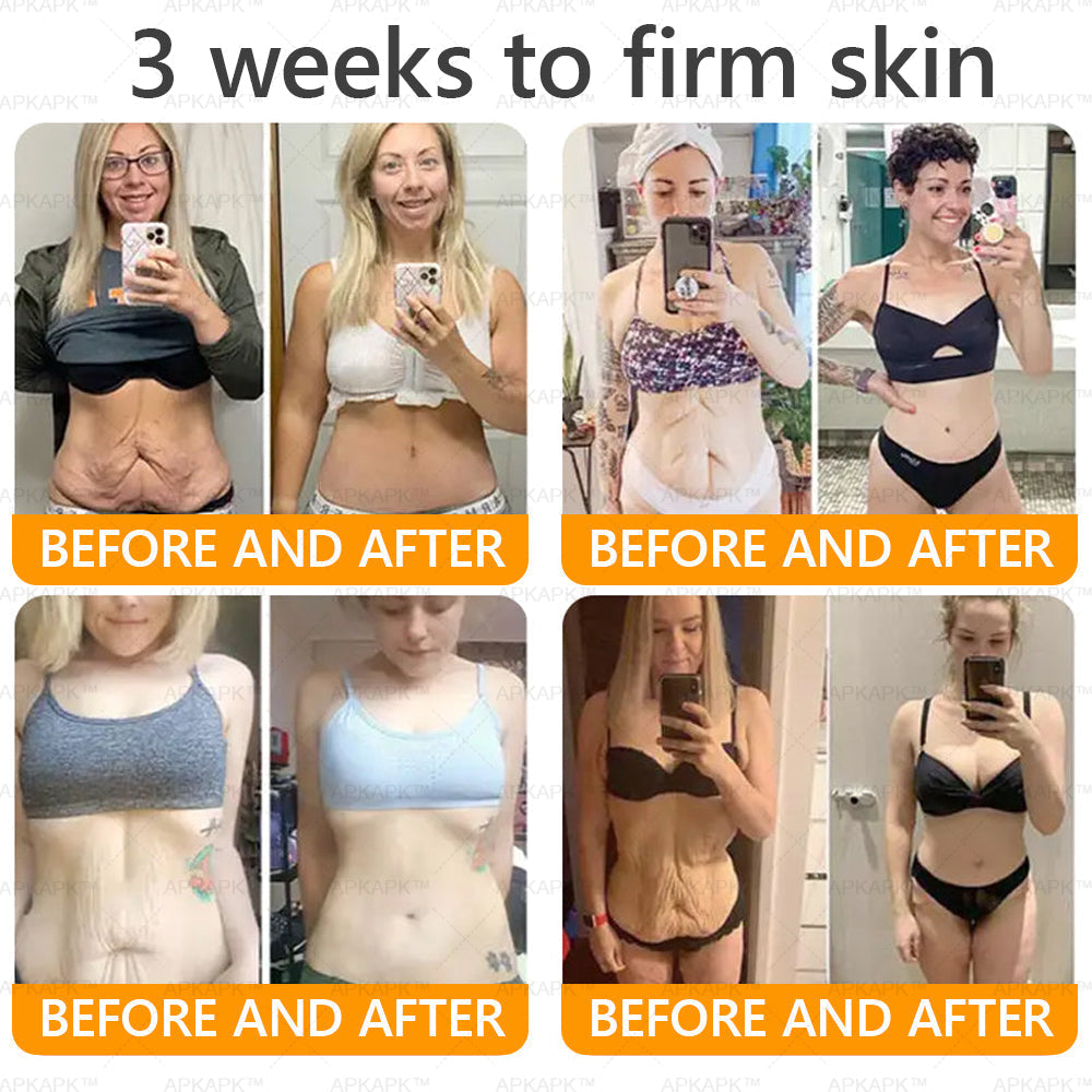 APKAPK®--Only 10 jars! Grab an exclusive 30% discount now! Keep your skin youthful and glowing in just 1 to 3 weeks. Don’t miss your chance—this offer won’t come around again until next year. Act fast! 180-day money back guarantee!