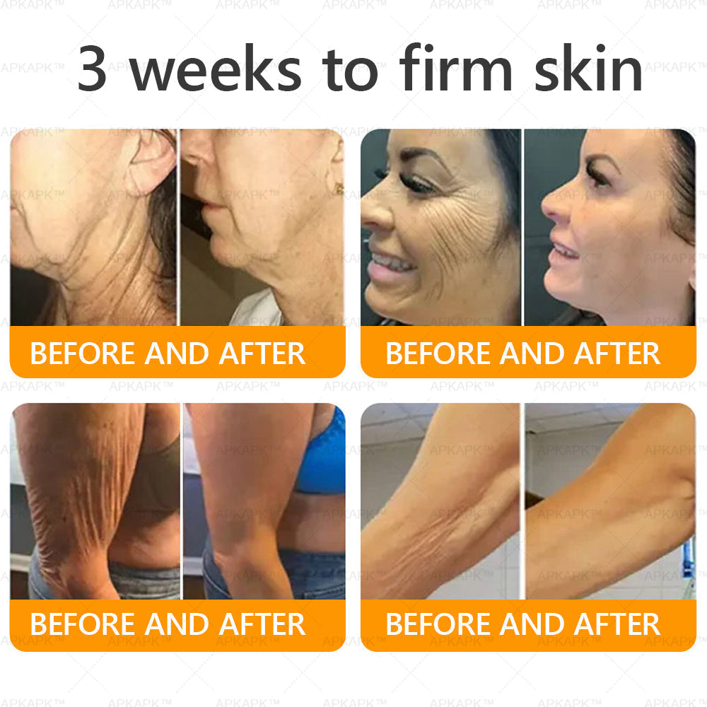 APKAPK®--Only 10 jars! Grab an exclusive 30% discount now! Keep your skin youthful and glowing in just 1 to 3 weeks. Don’t miss your chance—this offer won’t come around again until next year. Act fast! 180-day money back guarantee!