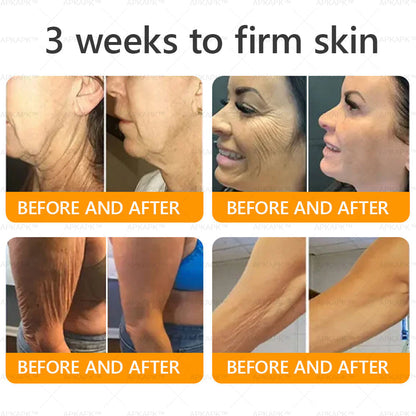 APKAPK®--Only 10 jars! Grab an exclusive 30% discount now! Keep your skin youthful and glowing in just 1 to 3 weeks. Don’t miss your chance—this offer won’t come around again until next year. Act fast! 180-day money back guarantee!