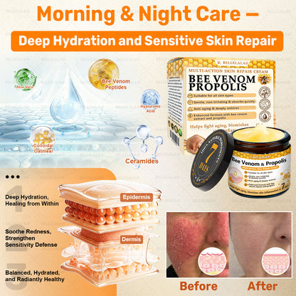 Official Store | 𝗕𝗘𝗟𝗟𝗘𝗟𝗔𝗟𝗔® 𝗕𝗲𝗲 𝗩𝗲𝗻𝗼𝗺 & 𝗣𝗿𝗼𝗽𝗼𝗹𝗶𝘀 𝗠𝘂𝗹𝘁𝗶-𝗔𝗰𝘁𝗶𝗼𝗻 𝗦𝗸𝗶𝗻 𝗥𝗲𝗽𝗮𝗶𝗿 𝗖𝗿𝗲𝗮𝗺 (Effective Within 7 Days)Bee Venom + 𝗣𝗿𝗼𝗽𝗼𝗹𝗶𝘀 · 7X Deep Hydration, targets wrinkles, sagging, stretch marks, dark spots, purpura, inflammations and more