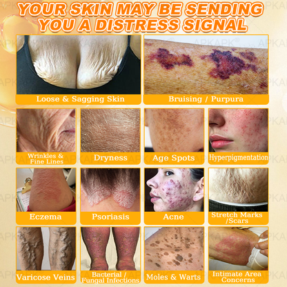 APKAPK®--Only 10 jars! Grab an exclusive 30% discount now! Keep your skin youthful and glowing in just 1 to 3 weeks. Don’t miss your chance—this offer won’t come around again until next year. Act fast! 180-day money back guarantee!