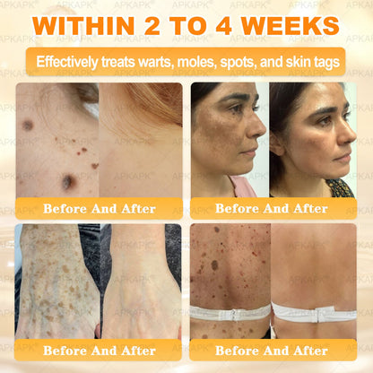 APKAPK®--Only 10 jars! Grab an exclusive 30% discount now! Keep your skin youthful and glowing in just 1 to 3 weeks. Don’t miss your chance—this offer won’t come around again until next year. Act fast! 180-day money back guarantee!