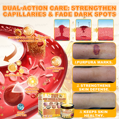 APKAPK®--Only 10 jars! Grab an exclusive 30% discount now! Keep your skin youthful and glowing in just 1 to 3 weeks. Don’t miss your chance—this offer won’t come around again until next year. Act fast! 180-day money back guarantee!