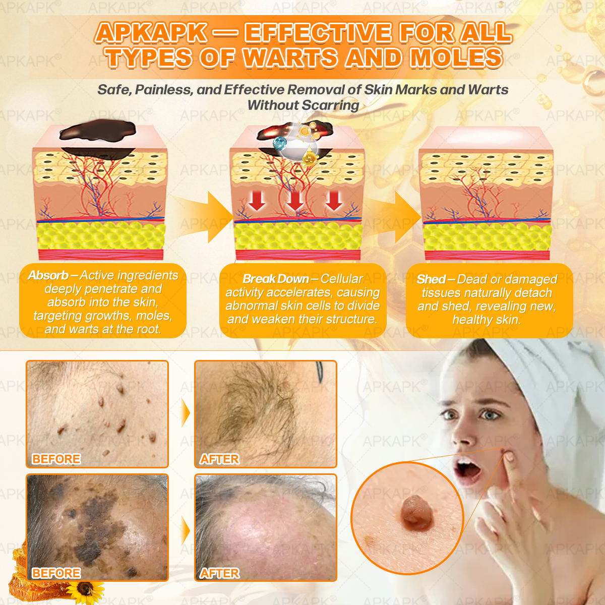 APKAPK®--Only 10 jars! Grab an exclusive 30% discount now! Keep your skin youthful and glowing in just 1 to 3 weeks. Don’t miss your chance—this offer won’t come around again until next year. Act fast! 180-day money back guarantee!