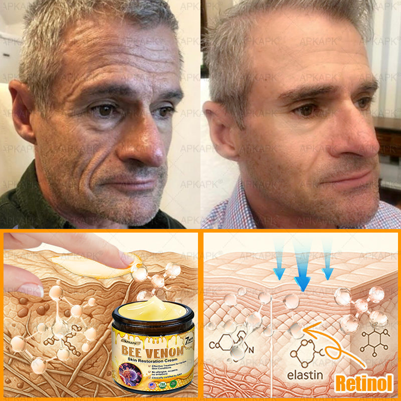 APKAPK®--Only 10 jars! Grab an exclusive 30% discount now! Keep your skin youthful and glowing in just 1 to 3 weeks. Don’t miss your chance—this offer won’t come around again until next year. Act fast! 180-day money back guarantee!