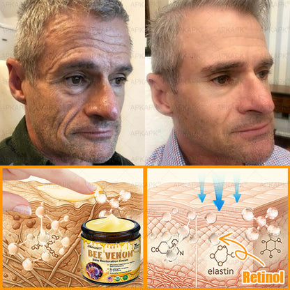 APKAPK®--Only 10 jars! Grab an exclusive 30% discount now! Keep your skin youthful and glowing in just 1 to 3 weeks. Don’t miss your chance—this offer won’t come around again until next year. Act fast! 180-day money back guarantee!