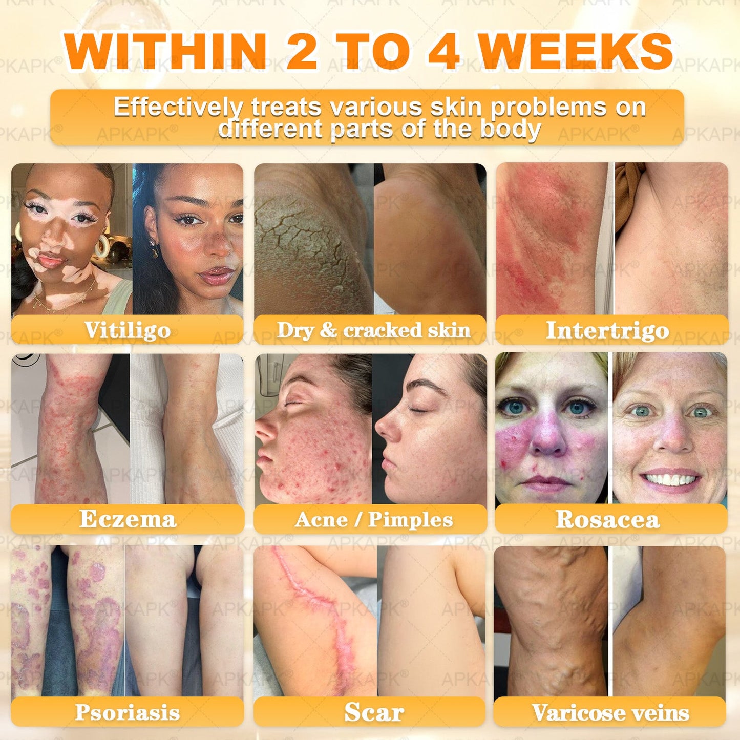 APKAPK®--Only 10 jars! Grab an exclusive 30% discount now! Keep your skin youthful and glowing in just 1 to 3 weeks. Don’t miss your chance—this offer won’t come around again until next year. Act fast! 180-day money back guarantee!