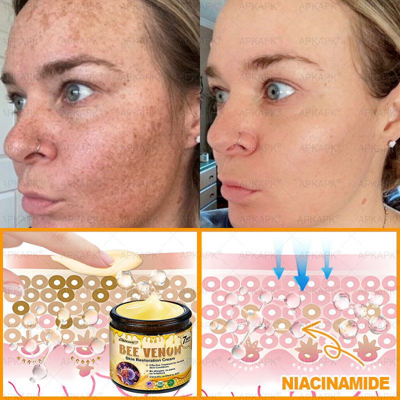 APKAPK®--Only 10 jars! Grab an exclusive 30% discount now! Keep your skin youthful and glowing in just 1 to 3 weeks. Don’t miss your chance—this offer won’t come around again until next year. Act fast! 180-day money back guarantee!