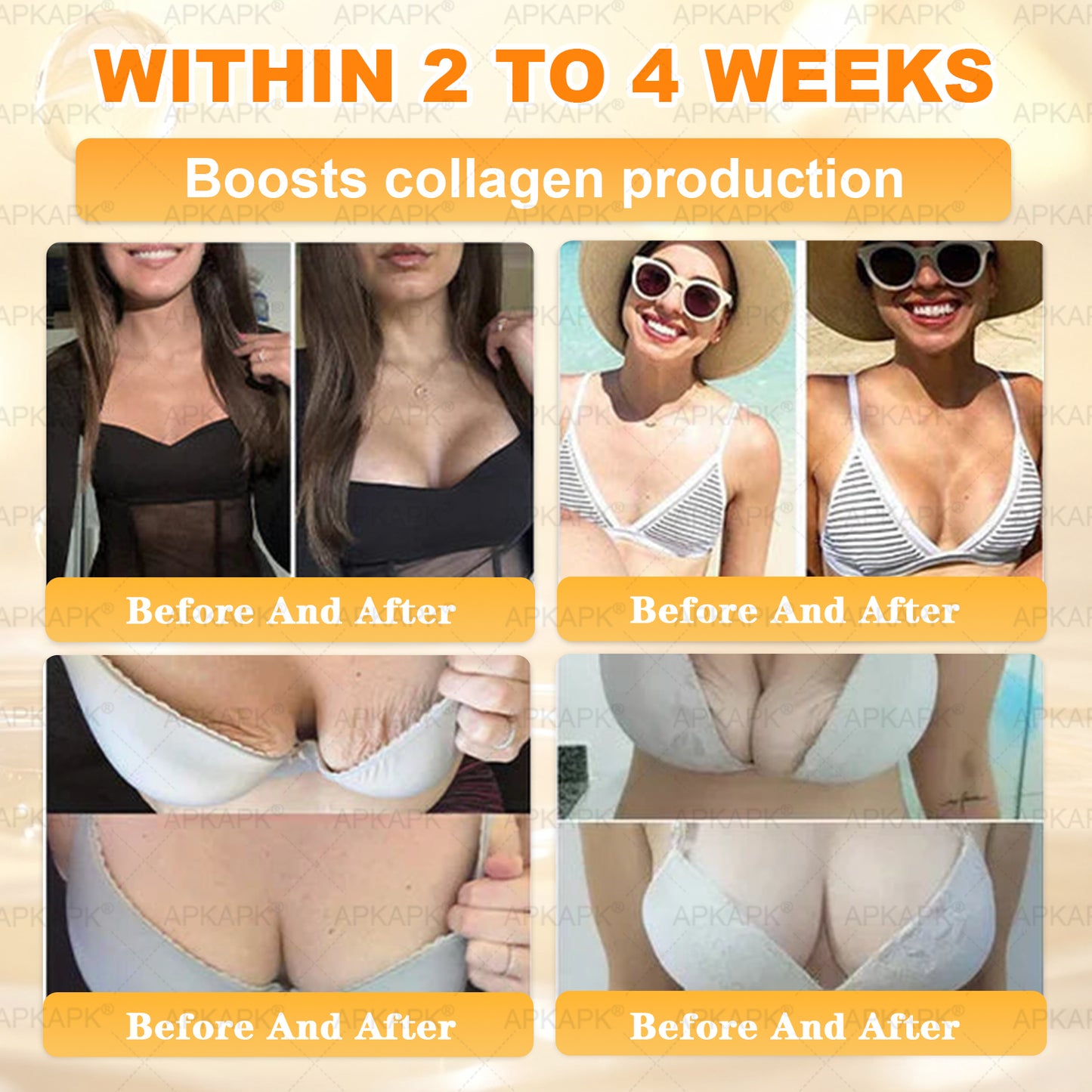 🌟Official Store | 𝐀𝐏𝐊𝐀𝐏𝐊® 𝟖-𝐈𝐧-𝟏 𝐁𝐞𝐞 𝐕𝐞𝐧𝐨𝐦 & 𝐓𝐚𝐥𝐥𝐨𝐰 𝐒𝐤𝐢𝐧 𝐅𝐢𝐫𝐦𝐢𝐧𝐠 & 𝐓𝐫𝐞𝐚𝐭𝐦𝐞𝐧𝐭 𝐂𝐫𝐞𝐚𝐦 (Effective Within 7 Days)Bee Venom + Tallow · 7X Deep Hydration, targets wrinkles, sagging, stretch marks, dark spots, purpura, inflammations and more