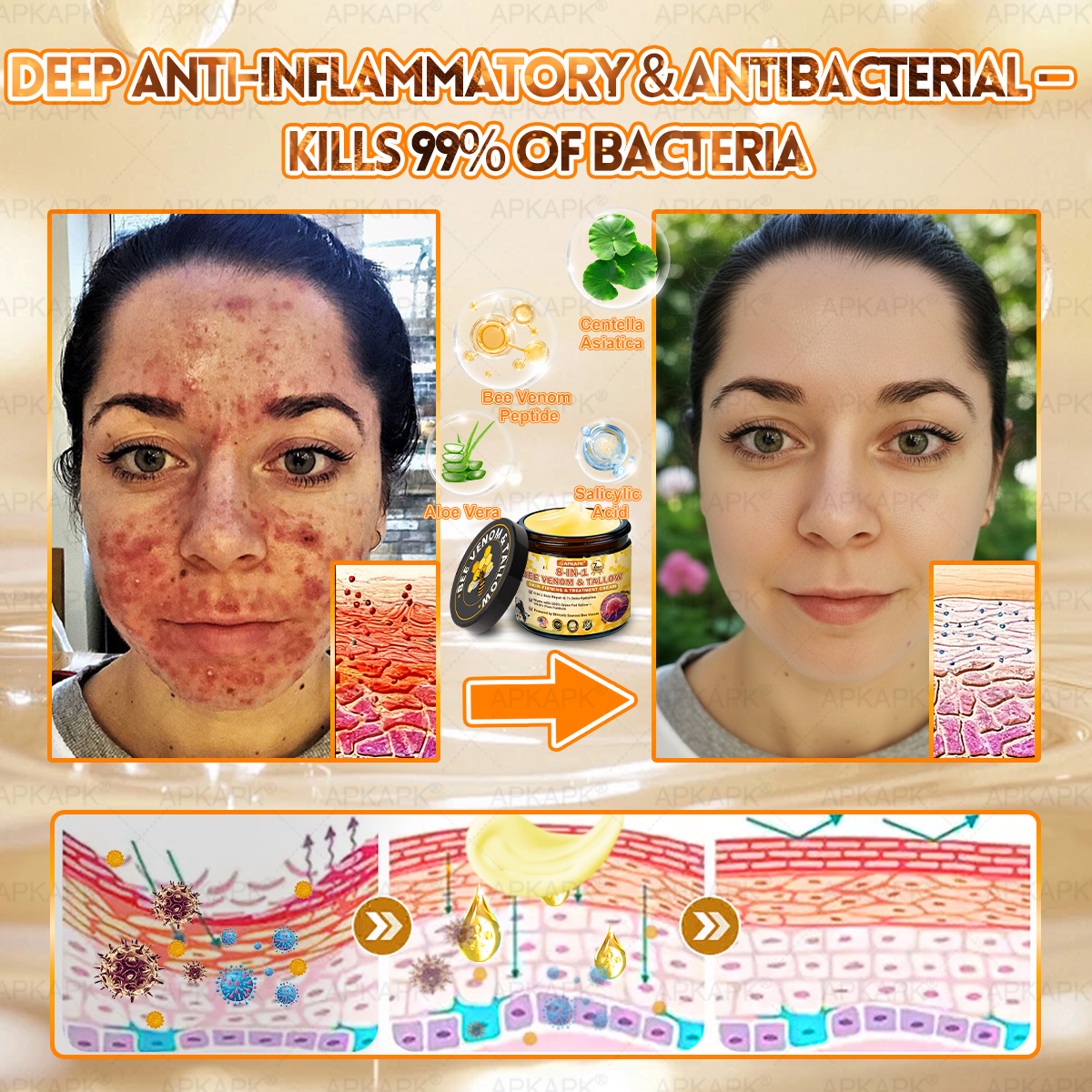 APKAPK®--Only 10 jars! Grab an exclusive 30% discount now! Keep your skin youthful and glowing in just 1 to 3 weeks. Don’t miss your chance—this offer won’t come around again until next year. Act fast! 180-day money back guarantee!