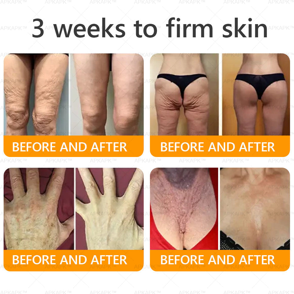 APKAPK®--Only 10 jars! Grab an exclusive 30% discount now! Keep your skin youthful and glowing in just 1 to 3 weeks. Don’t miss your chance—this offer won’t come around again until next year. Act fast! 180-day money back guarantee!