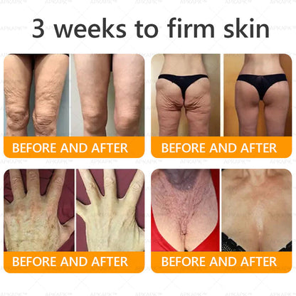 APKAPK®--Only 10 jars! Grab an exclusive 30% discount now! Keep your skin youthful and glowing in just 1 to 3 weeks. Don’t miss your chance—this offer won’t come around again until next year. Act fast! 180-day money back guarantee!