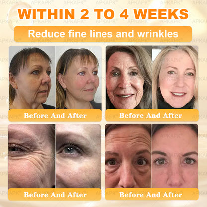 🌟Official Store | 𝐀𝐏𝐊𝐀𝐏𝐊® 𝟖-𝐈𝐧-𝟏 𝐁𝐞𝐞 𝐕𝐞𝐧𝐨𝐦 & 𝐓𝐚𝐥𝐥𝐨𝐰 𝐒𝐤𝐢𝐧 𝐅𝐢𝐫𝐦𝐢𝐧𝐠 & 𝐓𝐫𝐞𝐚𝐭𝐦𝐞𝐧𝐭 𝐂𝐫𝐞𝐚𝐦 (Effective Within 7 Days)Bee Venom + Tallow · 7X Deep Hydration, targets wrinkles, sagging, stretch marks, dark spots, purpura, inflammations and more