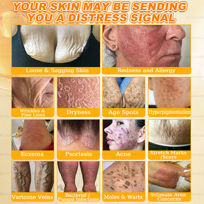 Official Store | 𝗕𝗘𝗟𝗟𝗘𝗟𝗔𝗟𝗔® 𝗕𝗲𝗲 𝗩𝗲𝗻𝗼𝗺 & 𝗣𝗿𝗼𝗽𝗼𝗹𝗶𝘀 𝗠𝘂𝗹𝘁𝗶-𝗔𝗰𝘁𝗶𝗼𝗻 𝗦𝗸𝗶𝗻 𝗥𝗲𝗽𝗮𝗶𝗿 𝗖𝗿𝗲𝗮𝗺 (Effective Within 7 Days)Bee Venom + 𝗣𝗿𝗼𝗽𝗼𝗹𝗶𝘀 · 7X Deep Hydration, targets wrinkles, sagging, stretch marks, dark spots, purpura, inflammations and more