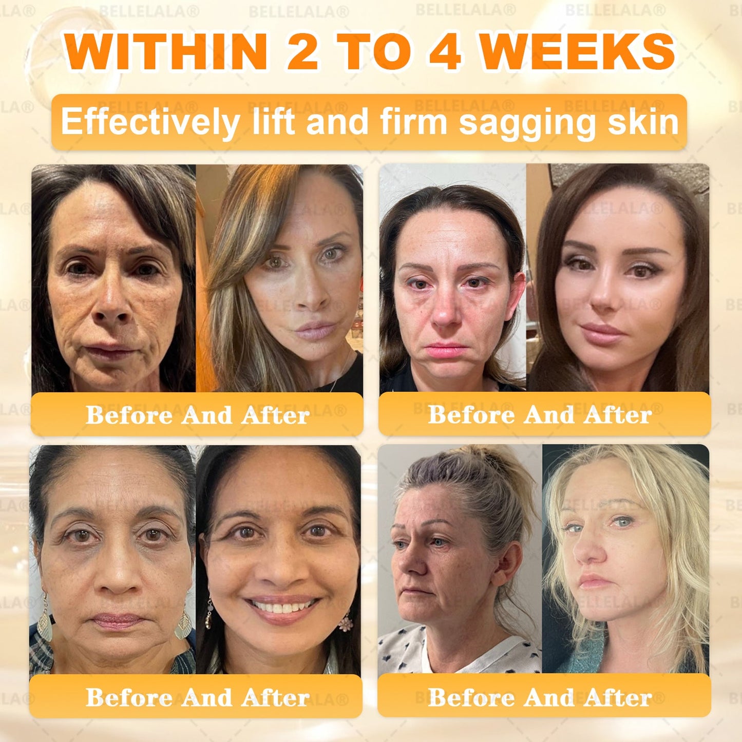 Official Store | 𝗕𝗘𝗟𝗟𝗘𝗟𝗔𝗟𝗔® 𝗕𝗲𝗲 𝗩𝗲𝗻𝗼𝗺 & 𝗣𝗿𝗼𝗽𝗼𝗹𝗶𝘀 𝗠𝘂𝗹𝘁𝗶-𝗔𝗰𝘁𝗶𝗼𝗻 𝗦𝗸𝗶𝗻 𝗥𝗲𝗽𝗮𝗶𝗿 𝗖𝗿𝗲𝗮𝗺 (Effective Within 7 Days)Bee Venom + 𝗣𝗿𝗼𝗽𝗼𝗹𝗶𝘀 · 7X Deep Hydration, targets wrinkles, sagging, stretch marks, dark spots, purpura, inflammations and more