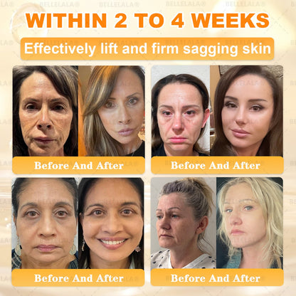 Official Store | 𝗕𝗘𝗟𝗟𝗘𝗟𝗔𝗟𝗔® 𝗕𝗲𝗲 𝗩𝗲𝗻𝗼𝗺 & 𝗣𝗿𝗼𝗽𝗼𝗹𝗶𝘀 𝗠𝘂𝗹𝘁𝗶-𝗔𝗰𝘁𝗶𝗼𝗻 𝗦𝗸𝗶𝗻 𝗥𝗲𝗽𝗮𝗶𝗿 𝗖𝗿𝗲𝗮𝗺 (Effective Within 7 Days)Bee Venom + 𝗣𝗿𝗼𝗽𝗼𝗹𝗶𝘀 · 7X Deep Hydration, targets wrinkles, sagging, stretch marks, dark spots, purpura, inflammations and more