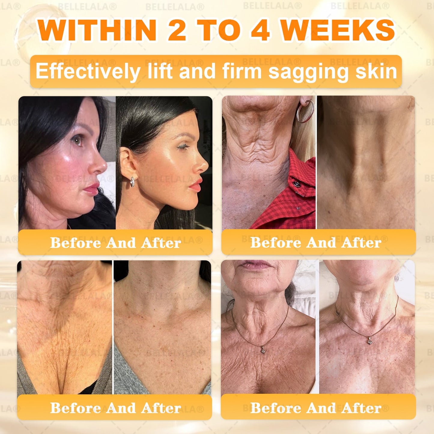 Official Store | 𝗕𝗘𝗟𝗟𝗘𝗟𝗔𝗟𝗔® 𝗕𝗲𝗲 𝗩𝗲𝗻𝗼𝗺 & 𝗣𝗿𝗼𝗽𝗼𝗹𝗶𝘀 𝗠𝘂𝗹𝘁𝗶-𝗔𝗰𝘁𝗶𝗼𝗻 𝗦𝗸𝗶𝗻 𝗥𝗲𝗽𝗮𝗶𝗿 𝗖𝗿𝗲𝗮𝗺 (Effective Within 7 Days)Bee Venom + 𝗣𝗿𝗼𝗽𝗼𝗹𝗶𝘀 · 7X Deep Hydration, targets wrinkles, sagging, stretch marks, dark spots, purpura, inflammations and more