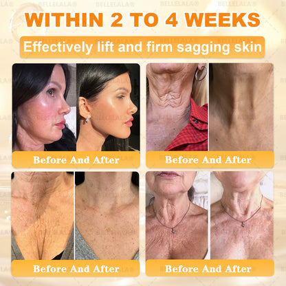 Official Store | 𝗕𝗘𝗟𝗟𝗘𝗟𝗔𝗟𝗔® 𝗕𝗲𝗲 𝗩𝗲𝗻𝗼𝗺 & 𝗣𝗿𝗼𝗽𝗼𝗹𝗶𝘀 𝗠𝘂𝗹𝘁𝗶-𝗔𝗰𝘁𝗶𝗼𝗻 𝗦𝗸𝗶𝗻 𝗥𝗲𝗽𝗮𝗶𝗿 𝗖𝗿𝗲𝗮𝗺 (Effective Within 7 Days)Bee Venom + 𝗣𝗿𝗼𝗽𝗼𝗹𝗶𝘀 · 7X Deep Hydration, targets wrinkles, sagging, stretch marks, dark spots, purpura, inflammations and more