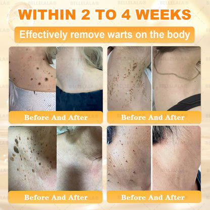 Official Store | 𝗕𝗘𝗟𝗟𝗘𝗟𝗔𝗟𝗔® 𝗕𝗲𝗲 𝗩𝗲𝗻𝗼𝗺 & 𝗣𝗿𝗼𝗽𝗼𝗹𝗶𝘀 𝗠𝘂𝗹𝘁𝗶-𝗔𝗰𝘁𝗶𝗼𝗻 𝗦𝗸𝗶𝗻 𝗥𝗲𝗽𝗮𝗶𝗿 𝗖𝗿𝗲𝗮𝗺 (Effective Within 7 Days)Bee Venom + 𝗣𝗿𝗼𝗽𝗼𝗹𝗶𝘀 · 7X Deep Hydration, targets wrinkles, sagging, stretch marks, dark spots, purpura, inflammations and more