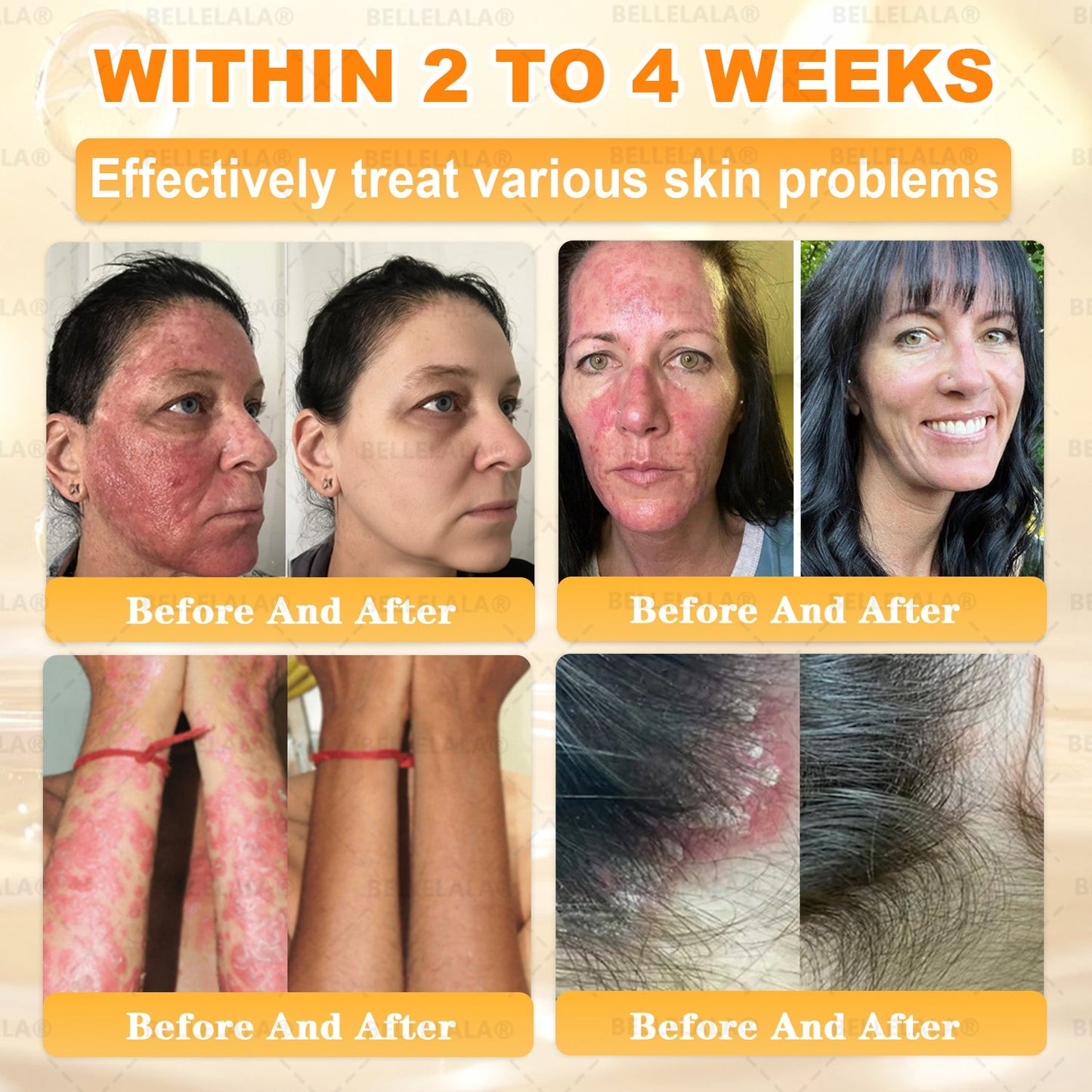 Official Store | 𝗕𝗘𝗟𝗟𝗘𝗟𝗔𝗟𝗔® 𝗕𝗲𝗲 𝗩𝗲𝗻𝗼𝗺 & 𝗣𝗿𝗼𝗽𝗼𝗹𝗶𝘀 𝗠𝘂𝗹𝘁𝗶-𝗔𝗰𝘁𝗶𝗼𝗻 𝗦𝗸𝗶𝗻 𝗥𝗲𝗽𝗮𝗶𝗿 𝗖𝗿𝗲𝗮𝗺 (Effective Within 7 Days)Bee Venom + 𝗣𝗿𝗼𝗽𝗼𝗹𝗶𝘀 · 7X Deep Hydration, targets wrinkles, sagging, stretch marks, dark spots, purpura, inflammations and more